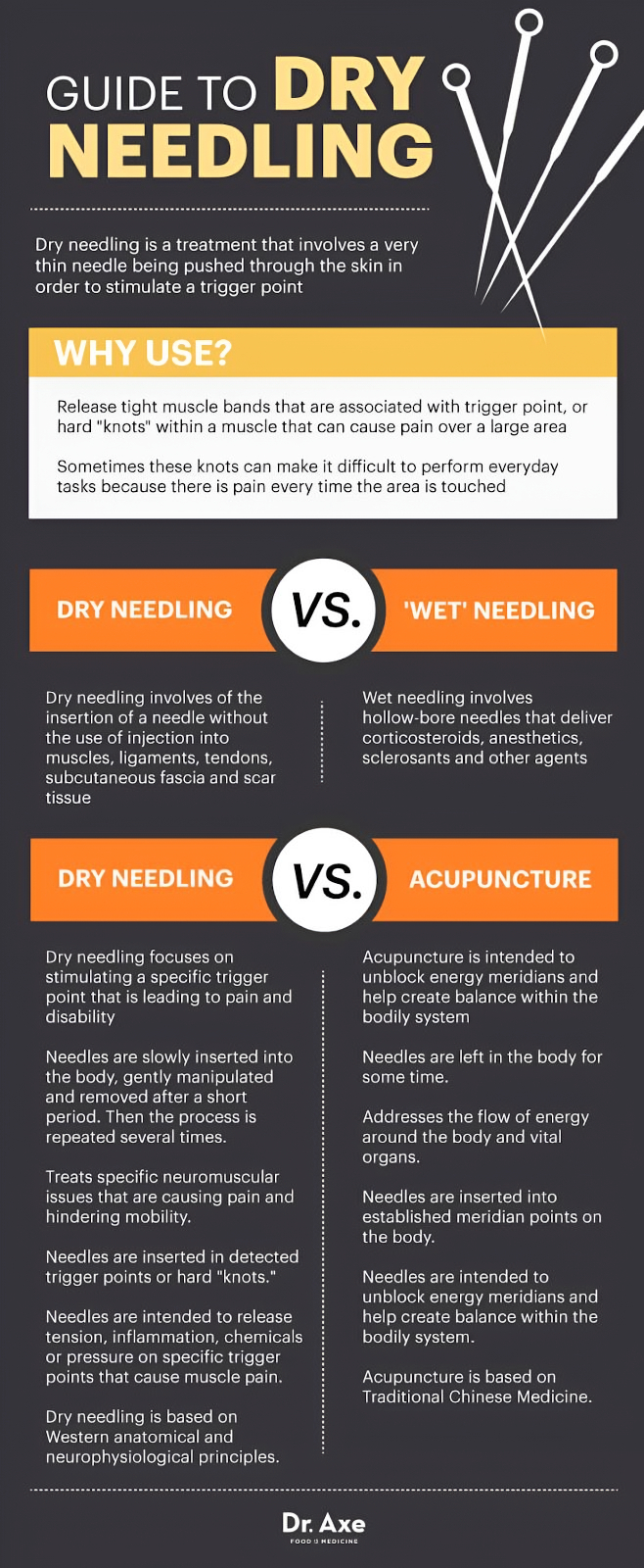 Dry Needling Loves Park IL